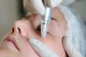 Botox A Classic Solution for Smooth, Wrinkle-Free Skin
